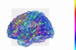 SimulationCerveauEpileptique